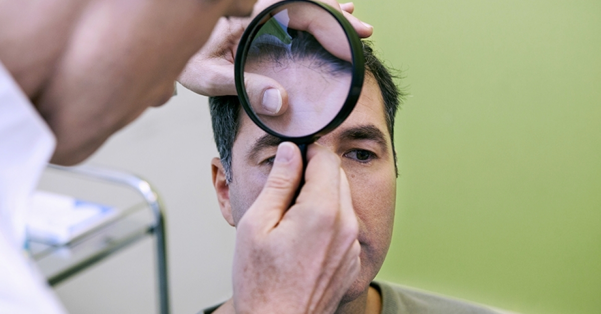 Optikai fejbőr és hajvizsgálat