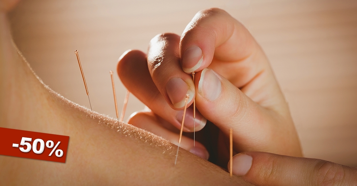 Akupunktúrás kezelés