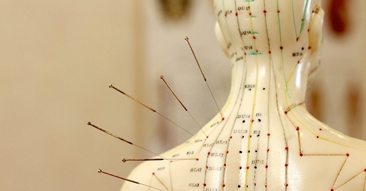 Akupunktúrás kezelés