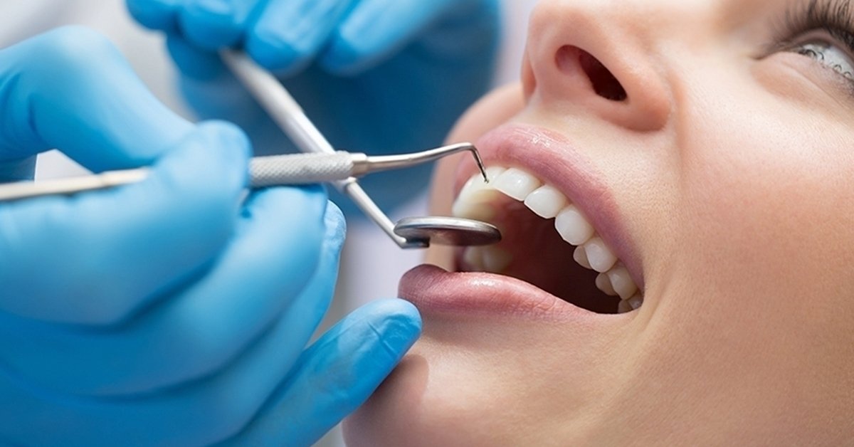 Választható fogászati kezelés