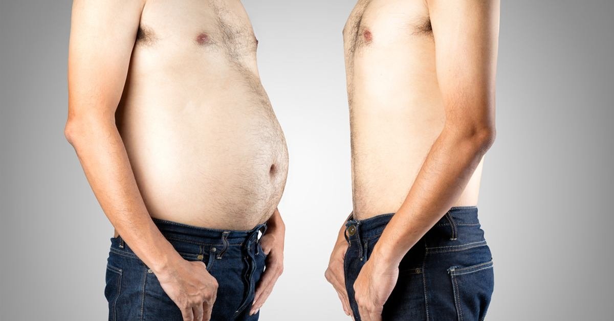 5 alkalmas zsírfagyasztás férfiaknak