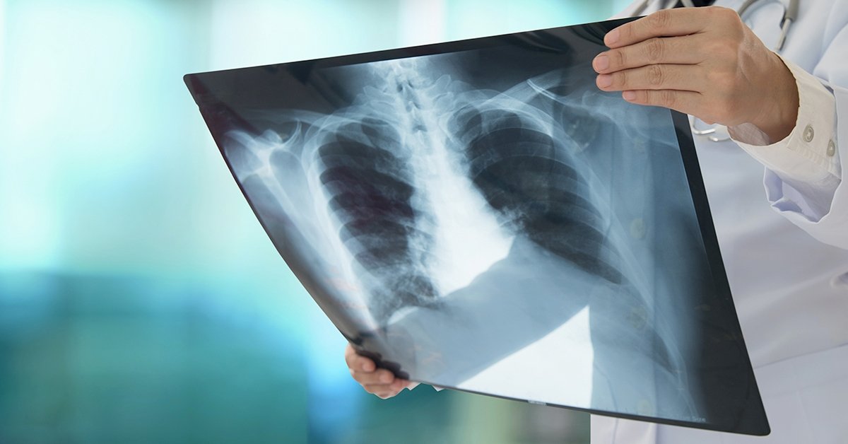 Kétoldali röntgen