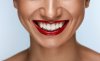 Profi Dental Whitening fogfehérítés fogászati szűréssel
