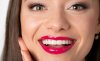 Vakítóan fehér fogak: otthoni sínes fogfehérítés