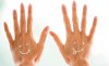 Kézfej fiatalító kezelés hyarulonsavas hatóanyaggal