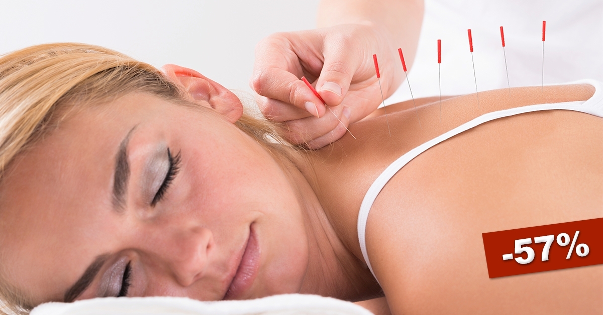 Test akupunktúrás kezelés