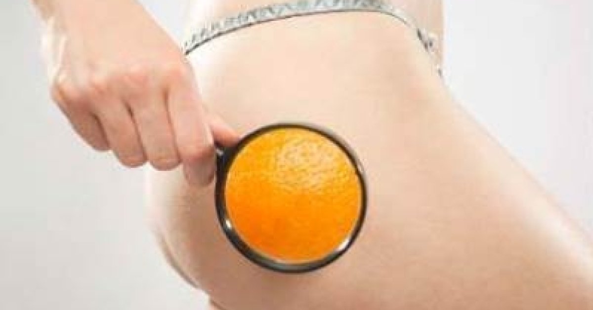 3 alkalmas narancsbőr elleni vákuumkezelés
