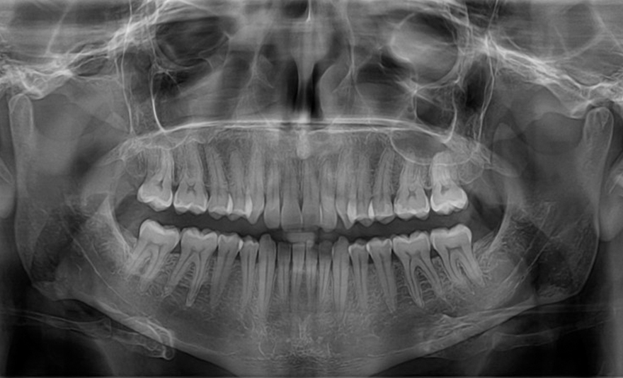 Csobánka téri fogászati röntgen